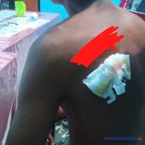 Sadis, Diduga Kades Labuhan Ratu Kampung Pukul dan Bacok Warganya Sendiri,  Bermodalkan Info Dari Dukun