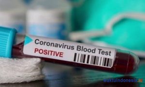 Ini Penjelasan Kadiskes Pesibar Terkait Penambahan 13 Orang Positif Covid-19