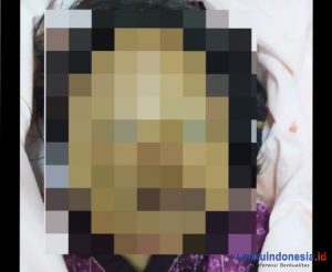 Ada Spion Pecah Sekitar Penemuan Mayat Wanita Muda di Kebagusan, RS Tunggu Hingga Pukul 12