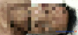 Pria di Karo Ditemukan Tewas di Atas Sepeda Motornya, Mesin dan Lampunya Menyala