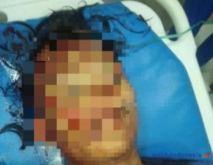 Farhan Tewas di Fly Over Amplas Medan Akibat Lemparan Balok dan Batu Segerombolan Pemuda